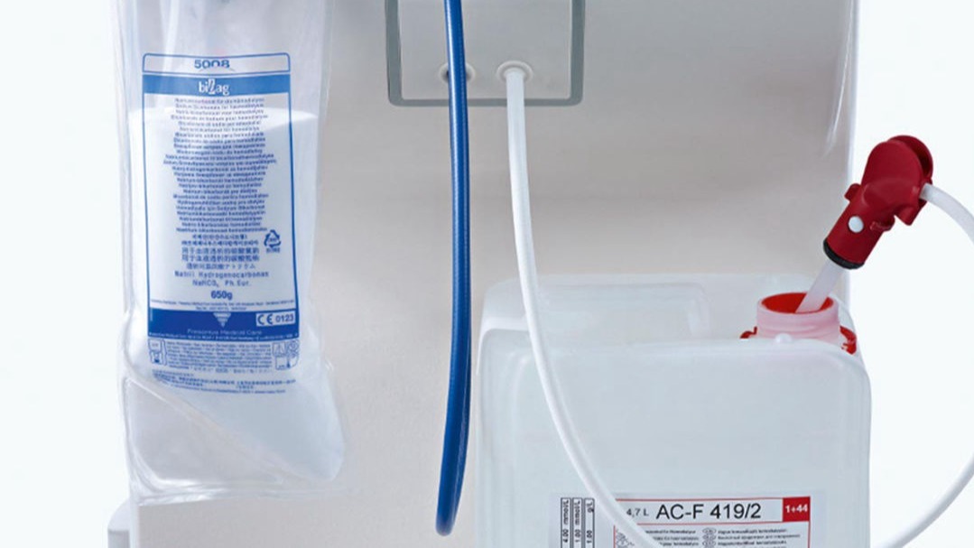 Bikarbonatlı Hemodiyaliz